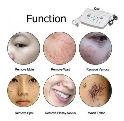 MAQUINA ULTRASONICA 3EN1 - Imagen 2